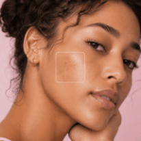 Dark Spots