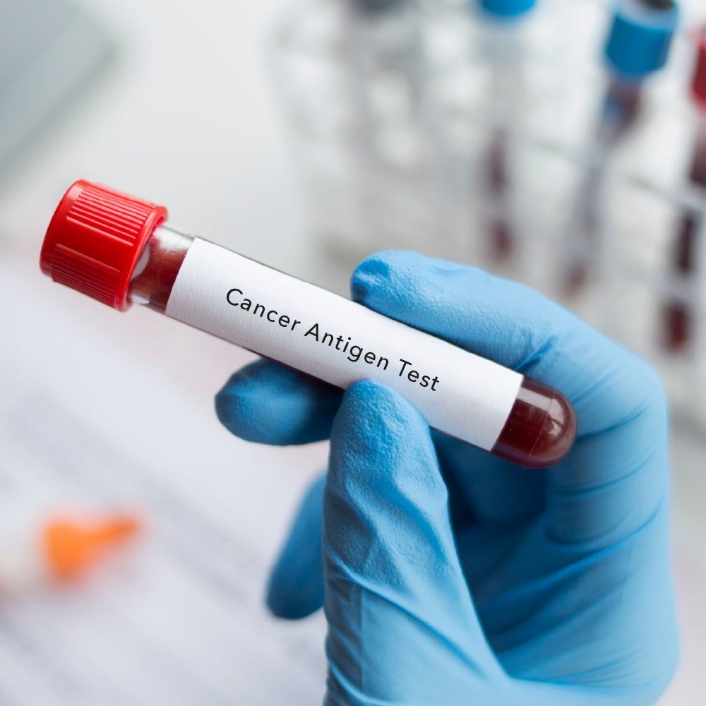 Book Cancer Screening at Home - Male in UAE with myAster