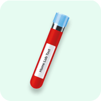 Home Lab Tests