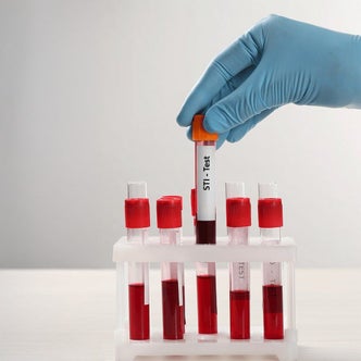 STD - Basic Package (7 Pathogens)